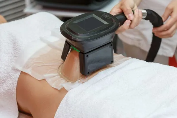 Image of person having fat freezing treatment to help weight gain Portobello