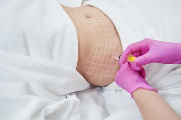 image of fat dissolving injections on love handles to help combat weight gain Portobello