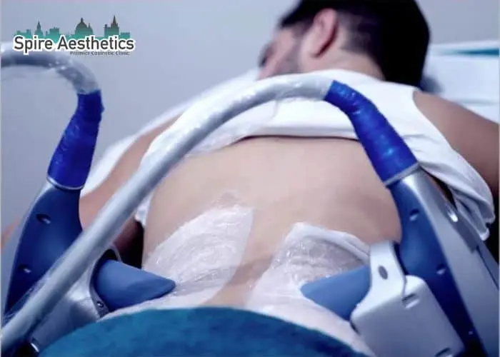 Man having fat freezing treatment done on love handles before a competitions Portobello to create a sculpted look.