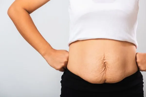 Image of a woman's stomach after weight loss with sagging skin following a gastric band Portobello